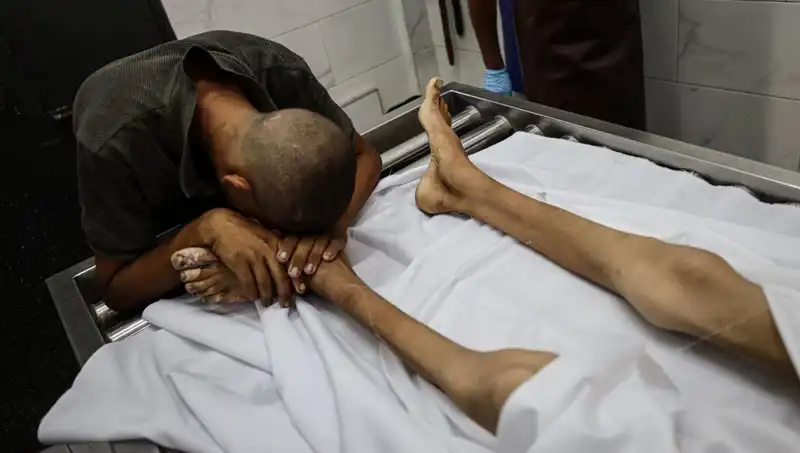 Gaza'da İkinci Çocuk Açlıktan Hayatını Kaybetti: Durum Giderek Kötülaşıyor
